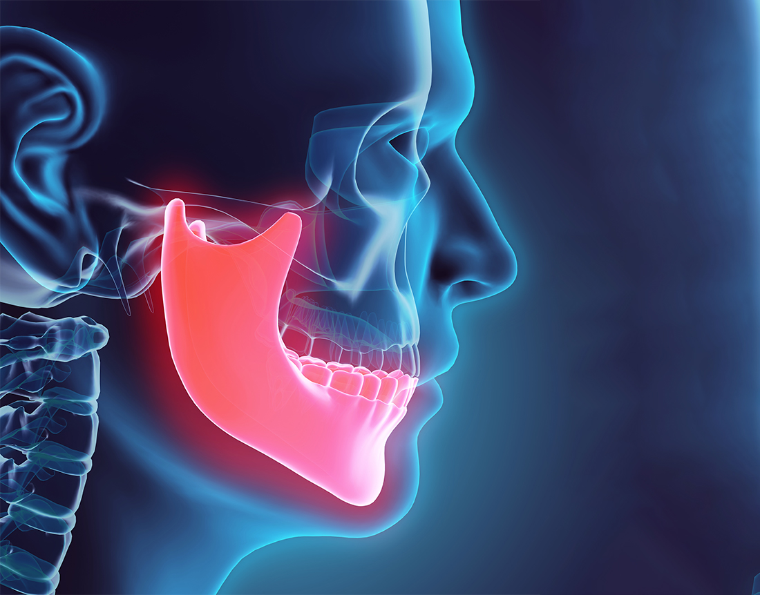 入れ歯によるリハビリ -顎（あご）に問題がある場合-