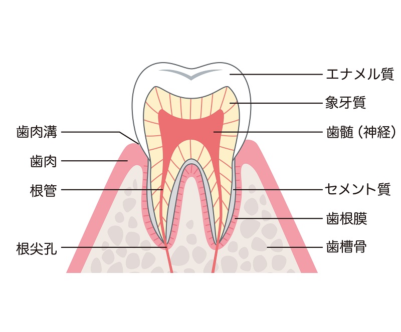 虫歯の深さによる分類