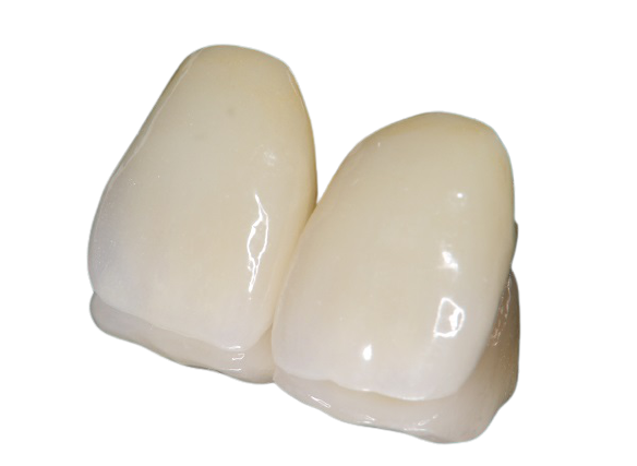 白くきれいな歯のかぶせ物