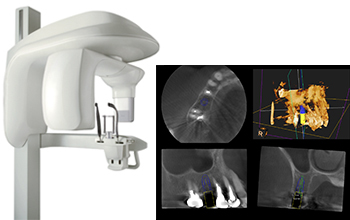 歯科用CT